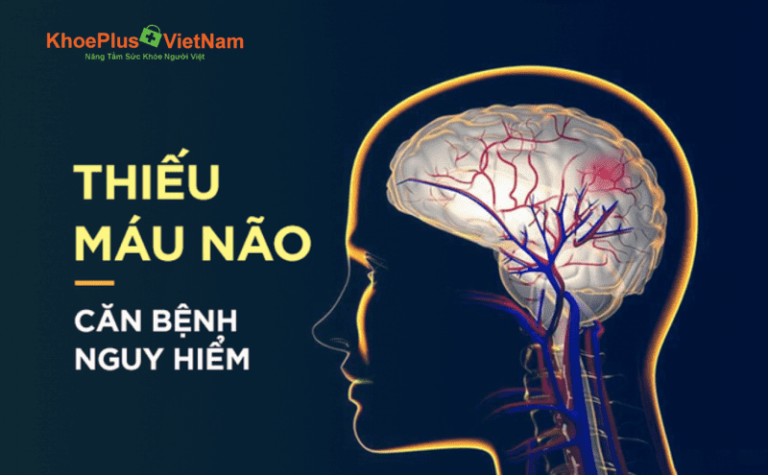 phân biệt rối loạn tiền đình và thiếu máu não